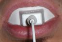 iPod Teeth Whitening System