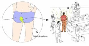 Patent to rid the smell of Wind poot-protector