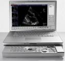 Siemens Laptop does Ultrasound