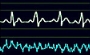 iPhone Lie Detector – iPolyGraph