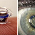 Tiny Telescopes Help the Blind to See