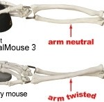 Vertical Mouse Prevents RSI
